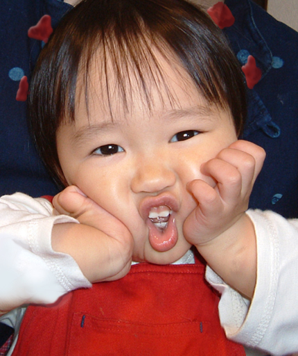 �A�b�`�����u���P�I