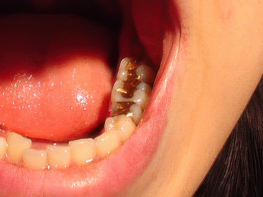 1-5-topaz-standard v2-2x.jpg