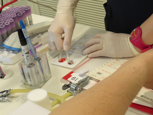 血液型検査、どっちが凝集するかで何型かわかる