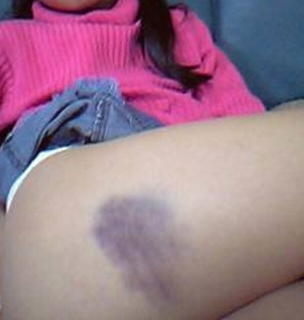 �X�e�L�Ȑ^��