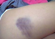 �X�e�L�Ȑ^��