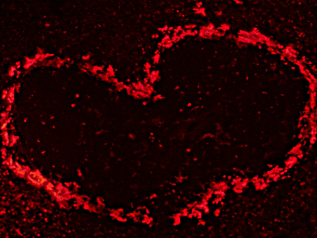 �n�[�g�݂̍菈